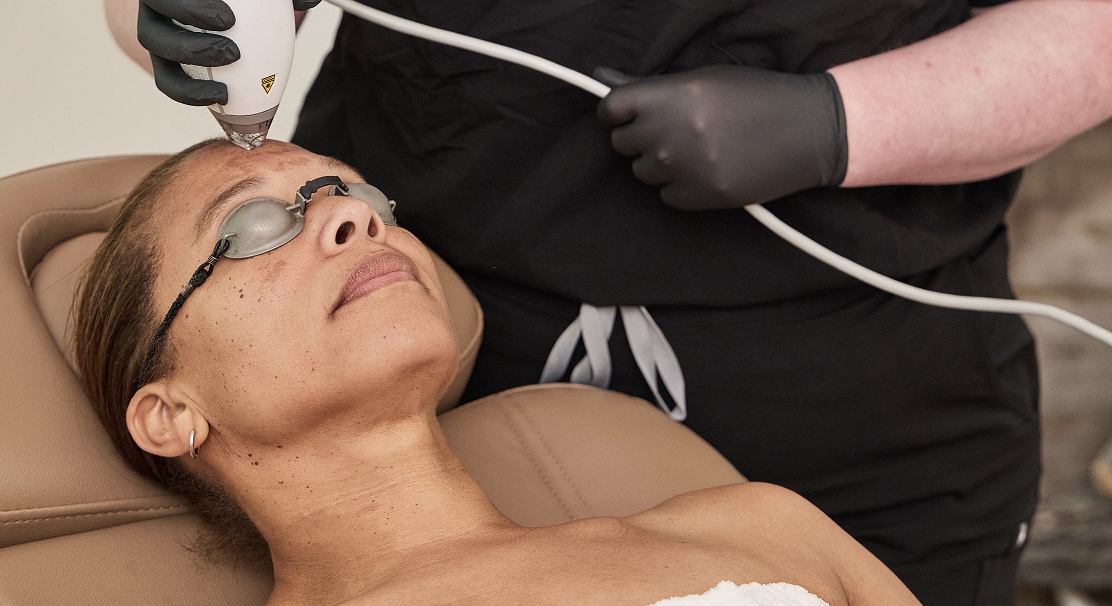 Facial treatment session with laser device.